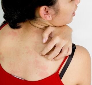 granulomas uz ķermeņa - parazītu klātbūtnes simptomi